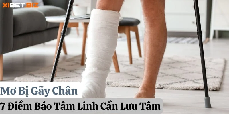 Mơ Bị Gãy Chân: 7 Điềm Báo Tâm Linh Cần Lưu Tâm