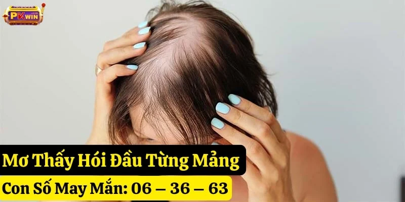 mơ thấy hói đầu