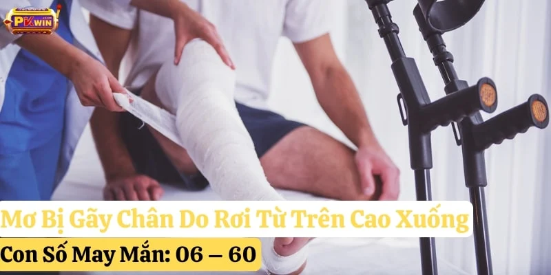 mơ bị gãy chân pkwin